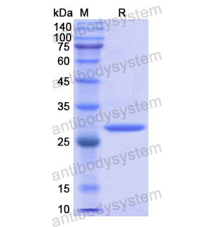 Recombinant Human PIM1, N-His