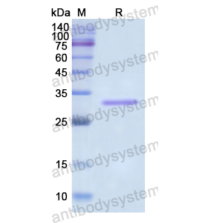 Recombinant Human TOP1, N-His