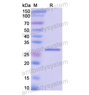 Recombinant Human TOP2A, N-His