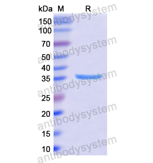 Recombinant Human PSG2, N-His