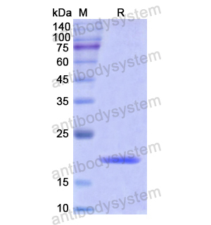 Recombinant Human VDR, N-His