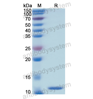 Recombinant Human SCGB1A1/Uteroglobin, N-His