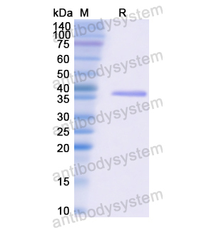 Recombinant Human CDK4, N-His