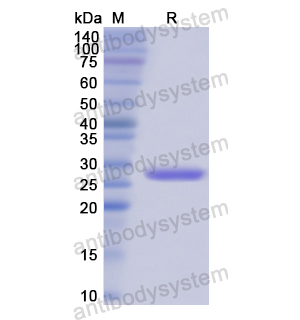 Recombinant Human SRF, N-His