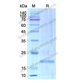 Recombinant Human CD20/MS4A1, N-His & N-Trx