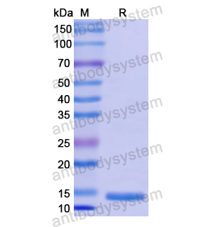 Recombinant Human CD179a/VPREB1, N-His
