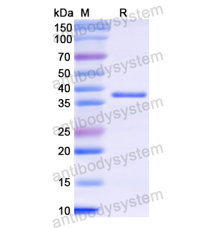 Recombinant Human KRT3, N-His