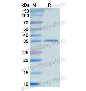Recombinant Human HARS1, N-His