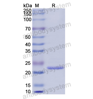 Recombinant Human COL6A3, N-His