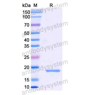 Recombinant Human PIP, N-His