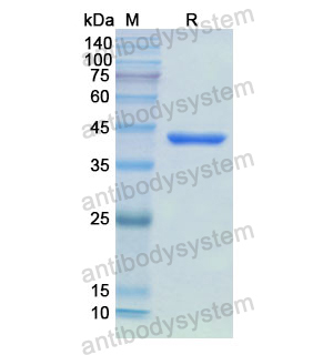 Recombinant Human CKB, N-His