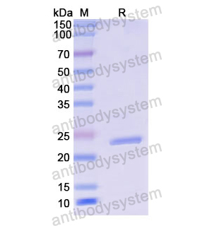 Recombinant Human CD64/FCGR1A, N-His