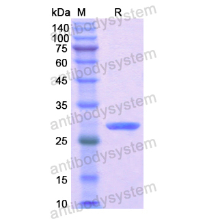 Recombinant Human MYH7, N-His