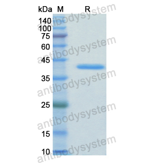 Recombinant Human SRC, N-His