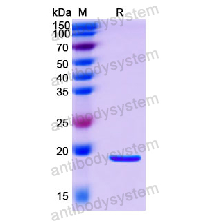 Recombinant Human COX4/COX4I1, N-His