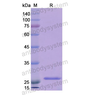Recombinant Human RNH1, N-His