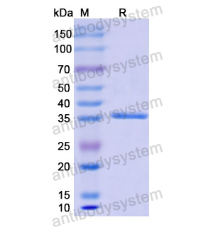 Recombinant Human KRT13, N-His