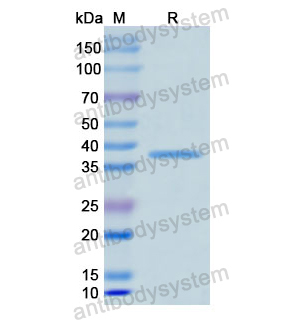 Recombinant Human KRT5, N-His