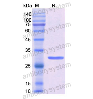 Recombinant Human C6, N-His