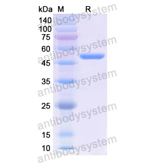 Recombinant Human ACP5, N-GST