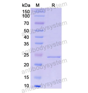 Recombinant Human OSM/Oncostatin-M, N-His
