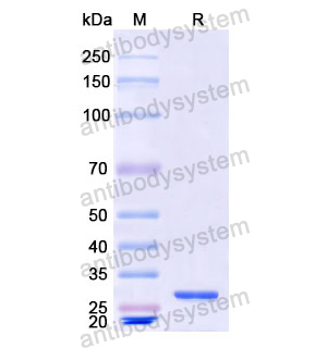 Recombinant Human LCP1, N-His