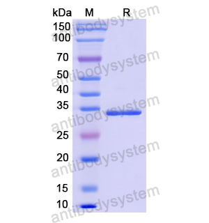 Recombinant Human TNNT1, N-His