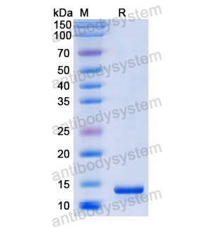 Recombinant Human MIF/GIF, N-His