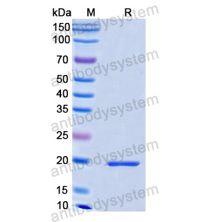 Recombinant Human DRD2, N-His