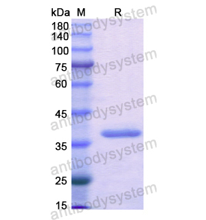 Recombinant Human ACYP2, N-GST