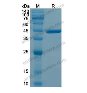 Recombinant Human HSP90B1, N-His