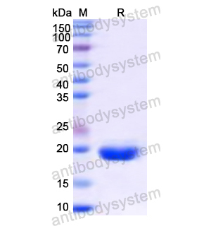 Recombinant Human GLUT4/SLC2A4, N-SUMO