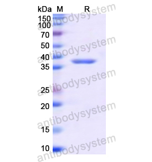Recombinant Human CD121a/IL1R1, N-GST