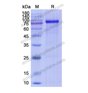 Recombinant Human MMP9, C-His