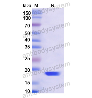 Recombinant Human DARS1, N-His