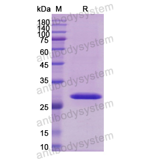 Recombinant Human CD119/IFNGR1, N-His
