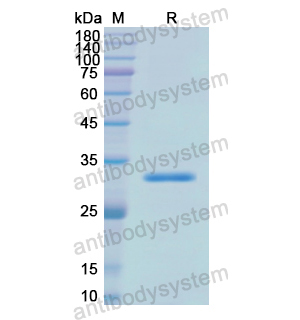 Recombinant Human ARSA, N-His