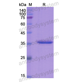 Recombinant Human EZR, N-His