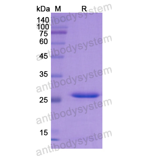 Recombinant Human FOLR1, N-His