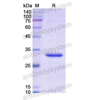 Recombinant Human FOSL1, N-His