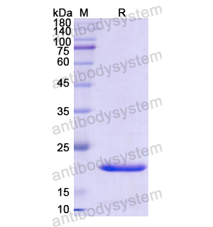 Recombinant Human CD116/CSF2RA, N-His