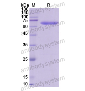 Recombinant Human CYP11B1, N-GST