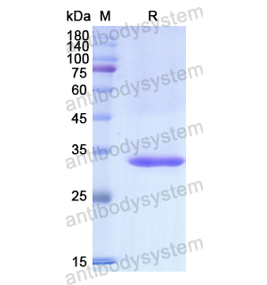 Recombinant Human NQO1, N-His