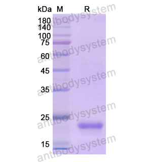Recombinant Human CD179b/IGLL1, N-His