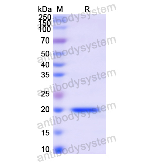 Recombinant Human CD62P/SELP, N-His