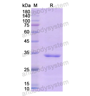 Recombinant Human CD104/ITGB4, N-His