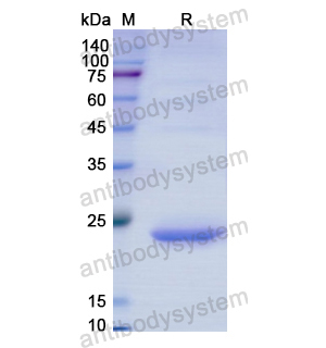 Recombinant Human ACADS, N-His