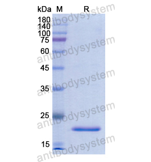Recombinant Human GLB1, N-His