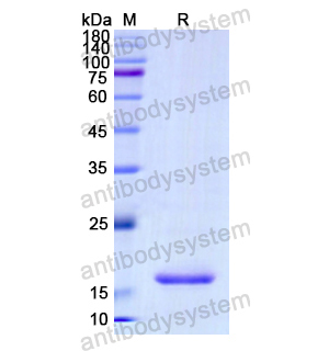 Recombinant Human PCSK2, N-His