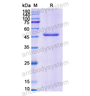 Recombinant Human ATP2A2, N-His